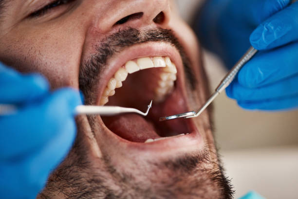 Best Same-Day Emergency Dental Services in Vicksburg, MI