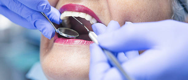 Best Emergency Gum Treatment in Vicksburg, MI
